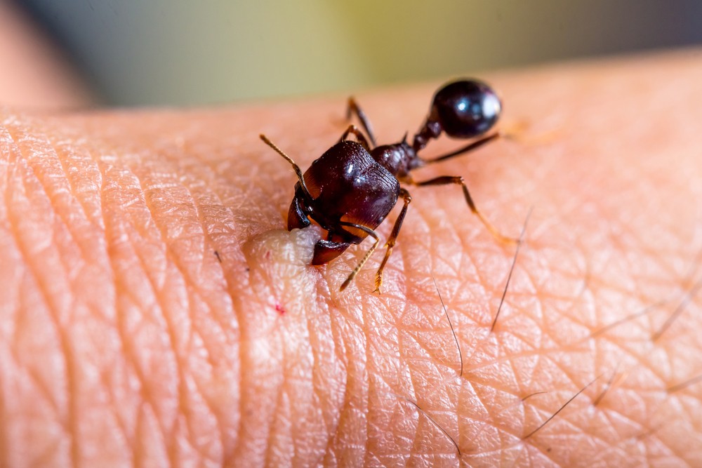 Black Ants Bite 