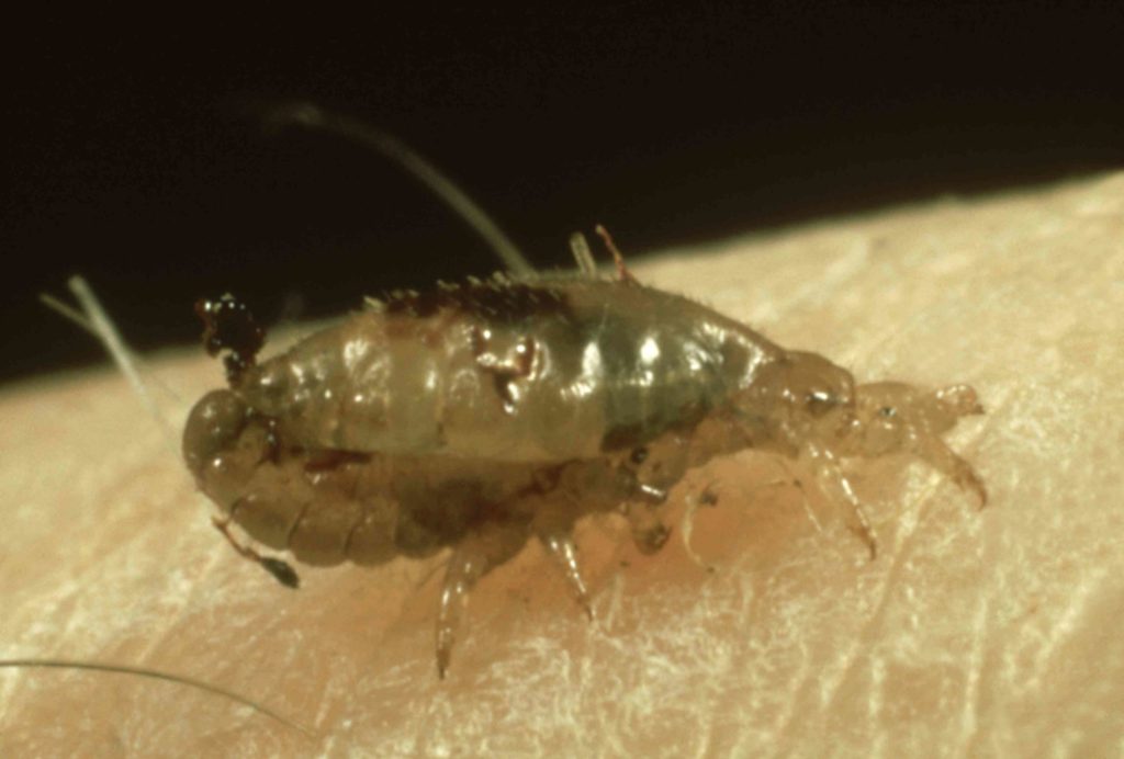 Bugs that look like lice